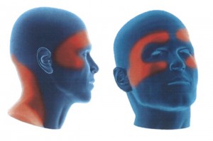 picture via: http://www.tkopainlaser.com/wp-content/uploads/2013/12/headache-tmj.jpg