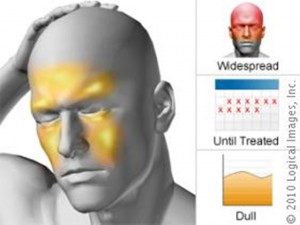picture via: http://www.skinsight.com/images/dx/webAtlas/sinusHeadache_59965_lg.jpg