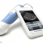 อัลตราซาวนด์ผ่านสมาร์ทโฟน แอพฯ ใหม่ของคุณแม่