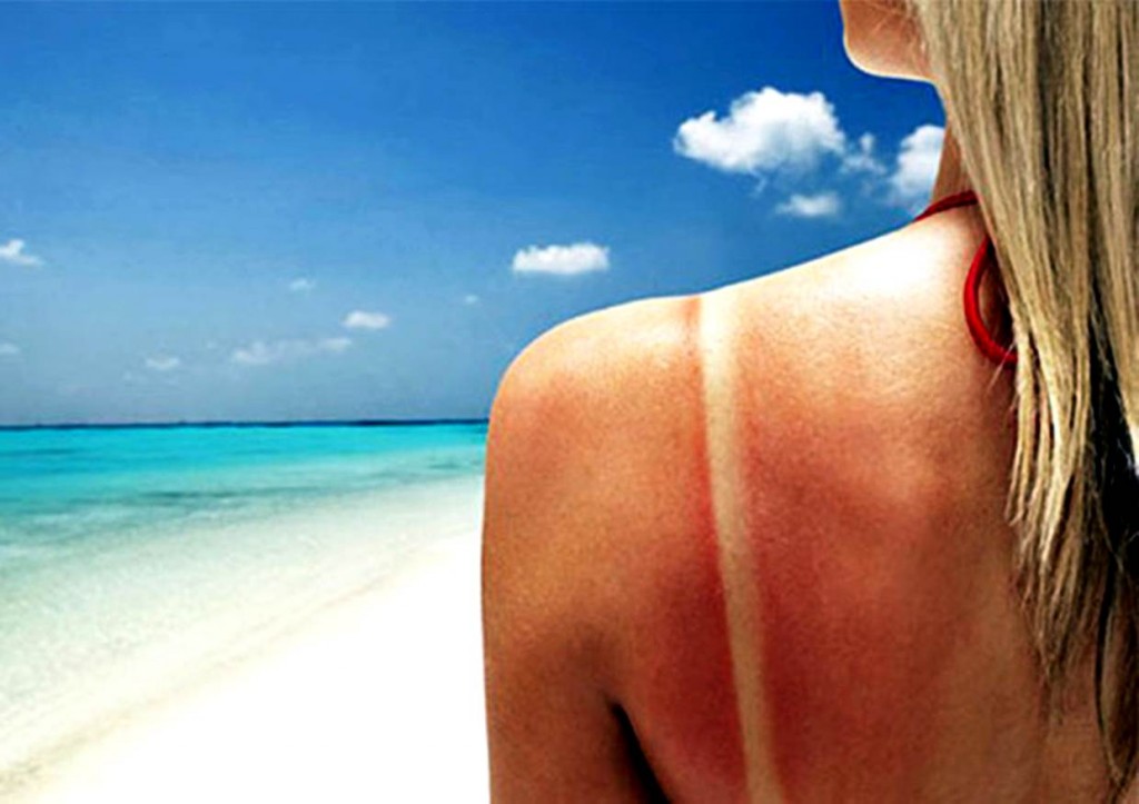 GoodaHR0cDovL3A0LmlzYW5vb2suY29tL3dvLzAvdWQvNy8zNjU2NS9jaGljLTIwMTUwNDE3LTA2MDAwOHByb3RlY3Qtc2tpbmJ1cm4tZnJvbS1zdW5saWdodC5qcGc=-20160408